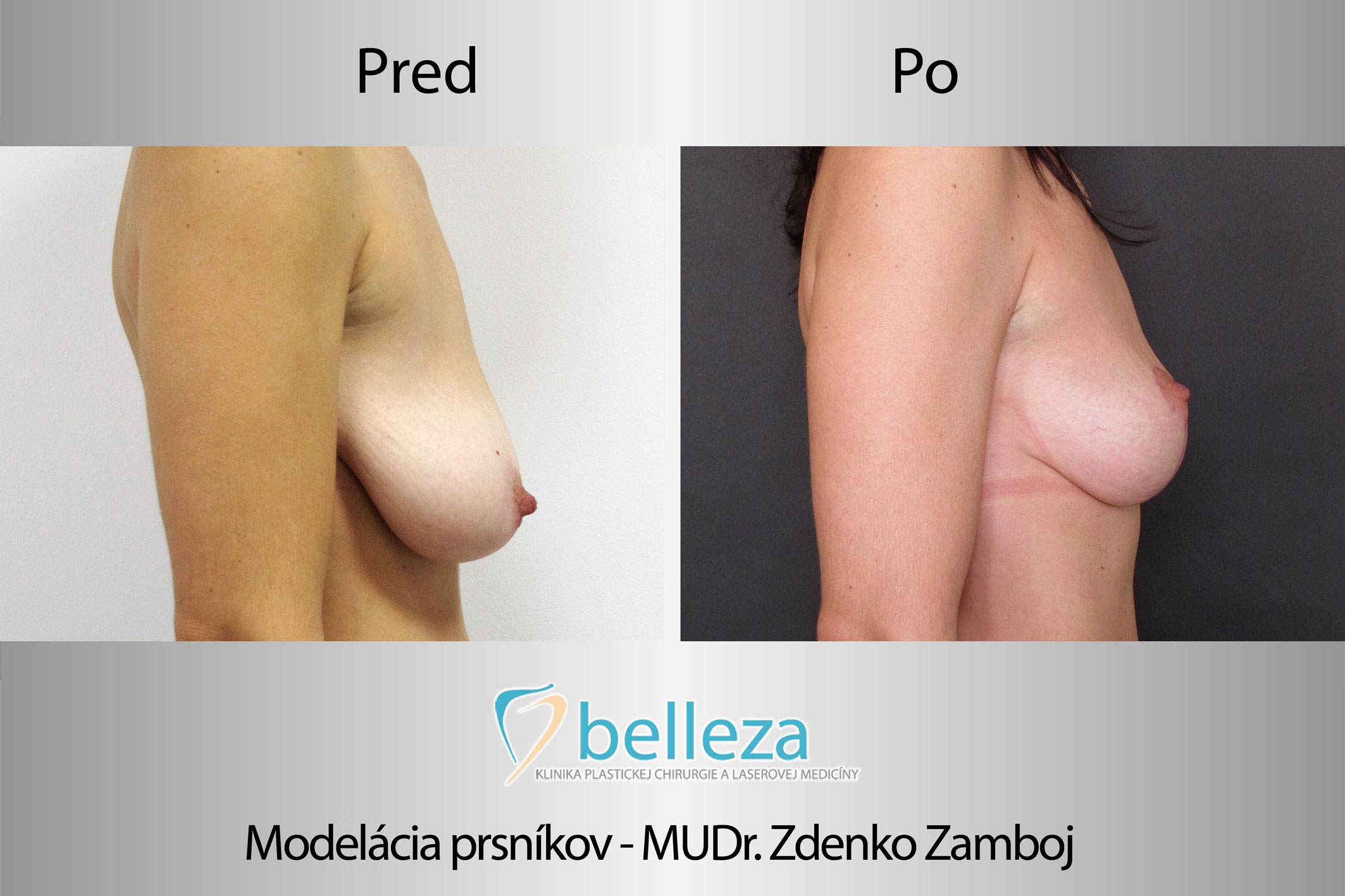 186_belleza_centrum_telo_modelovanie_prsnikov_mod-biga.jpg